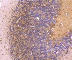 Invitrogen LC3A/LC3B Polyclonal Antibody 100 &mu;L; Unconjugated:Antibodies,