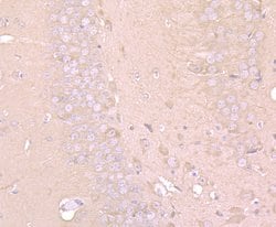 Invitrogen LC3A/LC3B Polyclonal Antibody 100 &mu;L; Unconjugated:Antibodies,