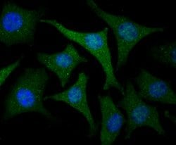 Thermo Scientific USP21 Polyclonal Antibody:Antibodies, Polyclonal