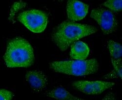 Thermo Scientific USP21 Polyclonal Antibody:Antibodies, Polyclonal