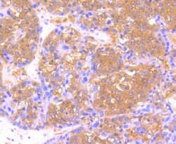Thermo Scientific USP21 Polyclonal Antibody:Antibodies, Polyclonal