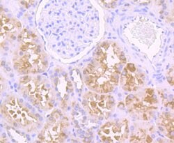 Thermo Scientific USP21 Polyclonal Antibody:Antibodies, Polyclonal