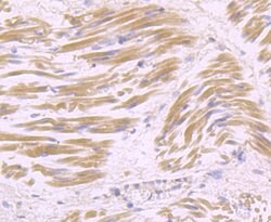Thermo Scientific USP21 Polyclonal Antibody:Antibodies, Polyclonal