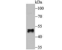 Invitrogen FOXF2 Polyclonal Antibody 100 μL; Unconjugated:Antibodies,