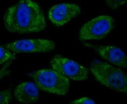 Invitrogen Noggin Polyclonal Antibody 100 &mu;L; Unconjugated:Antibodies,