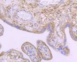 Invitrogen Noggin Polyclonal Antibody 100 &mu;L; Unconjugated:Antibodies,