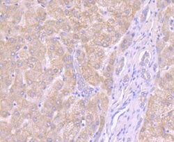 Invitrogen Noggin Polyclonal Antibody 100 &mu;L; Unconjugated:Antibodies,