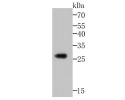Invitrogen Noggin Polyclonal Antibody 100 &mu;L; Unconjugated:Antibodies,