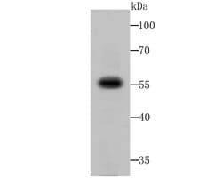 Invitrogen Fusion glycoprotein F0 Polyclonal Antibody 100 &mu;L; Unconjugated:Antibodies,