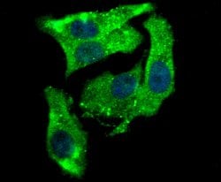 Invitrogen Aromatase Polyclonal Antibody 100 &mu;L; Unconjugated:Antibodies,