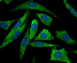 Invitrogen Aromatase Polyclonal Antibody 100 &mu;L; Unconjugated:Antibodies,