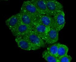 Invitrogen Aromatase Polyclonal Antibody 100 &mu;L; Unconjugated:Antibodies,