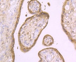 Invitrogen Aromatase Polyclonal Antibody 100 &mu;L; Unconjugated:Antibodies,