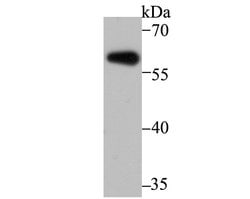 Invitrogen Aromatase Polyclonal Antibody 100 &mu;L; Unconjugated:Antibodies,