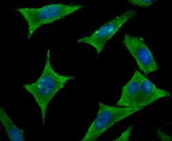 Invitrogen HIP1 Polyclonal Antibody 100 μL; Unconjugated:Antibodies,