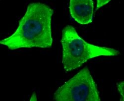 Invitrogen HIP1 Polyclonal Antibody 100 μL; Unconjugated:Antibodies,