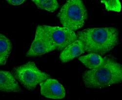 Invitrogen HIP1 Polyclonal Antibody 100 μL; Unconjugated:Antibodies,