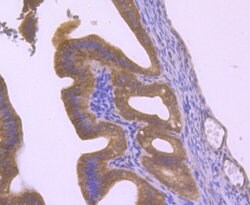 Invitrogen HIP1 Polyclonal Antibody 100 μL; Unconjugated:Antibodies,