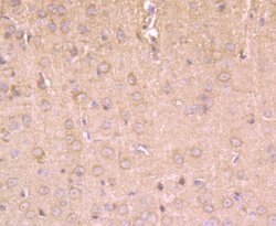Invitrogen HIP1 Polyclonal Antibody 100 μL; Unconjugated:Antibodies,