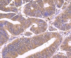 Invitrogen HIP1 Polyclonal Antibody 100 μL; Unconjugated:Antibodies,