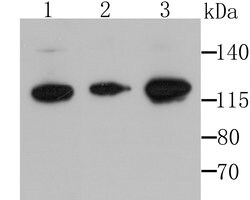 Invitrogen HIP1 Polyclonal Antibody 100 μL; Unconjugated:Antibodies,
