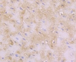 Invitrogen RAB7A Polyclonal Antibody 100 &mu;L; Unconjugated:Antibodies,