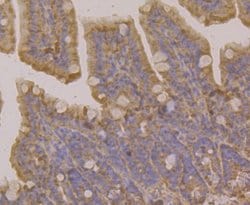 Invitrogen RAB7A Polyclonal Antibody 100 &mu;L; Unconjugated:Antibodies,