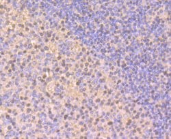Invitrogen RAB7A Polyclonal Antibody 100 &mu;L; Unconjugated:Antibodies,