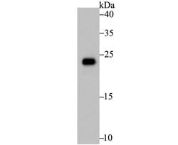 Invitrogen RAB7A Polyclonal Antibody 100 &mu;L; Unconjugated:Antibodies,