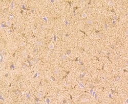 Invitrogen NGF Polyclonal Antibody 100 &mu;L | Buy Online | Invitrogen&trade; | Fisher Scientific