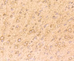 Invitrogen NGF Polyclonal Antibody 100 &mu;L | Buy Online | Invitrogen&trade; | Fisher Scientific