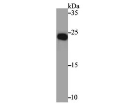 Invitrogen NGF Polyclonal Antibody 100 &mu;L | Buy Online | Invitrogen&trade; | Fisher Scientific