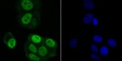 Thermo Scientific RAE1 Polyclonal Antibody:Antibodies, Polyclonal