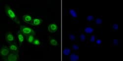 Thermo Scientific RAE1 Polyclonal Antibody:Antibodies, Polyclonal