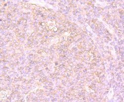 Invitrogen PTP1B Polyclonal Antibody 100 &mu;L; Unconjugated:Antibodies,