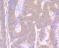 Invitrogen PTP1B Polyclonal Antibody 100 &mu;L; Unconjugated:Antibodies,