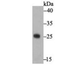 Invitrogen Staphylococcus Enterotoxin A Polyclonal Antibody 100 &mu;L;