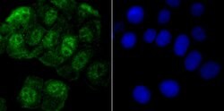 Invitrogen ROC1 Polyclonal Antibody 100 μL; Unconjugated:Antibodies,