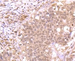 Invitrogen ROC1 Polyclonal Antibody 100 μL; Unconjugated:Antibodies,