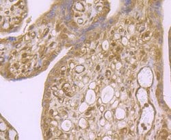 Invitrogen ROC1 Polyclonal Antibody 100 μL; Unconjugated:Antibodies,