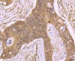 Invitrogen ROC1 Polyclonal Antibody 100 μL; Unconjugated:Antibodies,