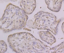 Thermo Scientific KV4.3 (KCND3) Polyclonal Antibody:Antibodies, Polyclonal