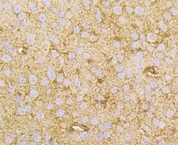 Invitrogen NDRG2 Polyclonal Antibody 100 &mu;L; Unconjugated:Antibodies,