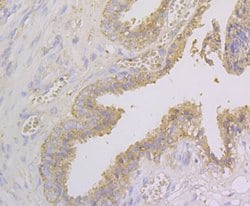 Invitrogen NDRG2 Polyclonal Antibody 100 &mu;L; Unconjugated:Antibodies,