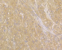 Invitrogen NDRG2 Polyclonal Antibody 100 &mu;L; Unconjugated:Antibodies,