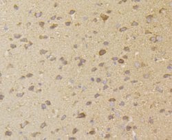 Invitrogen ERGIC3 Polyclonal Antibody 100 &mu;L; Unconjugated:Antibodies,