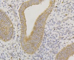 Invitrogen ERGIC3 Polyclonal Antibody 100 &mu;L; Unconjugated:Antibodies,