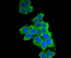 Invitrogen UAP1 Polyclonal Antibody:Antibodies:Primary Antibodies