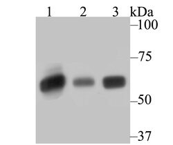 Invitrogen SERPINC1 Polyclonal Antibody 100 &mu;L; Unconjugated:Antibodies,