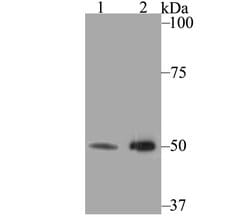 KCNK4 Polyclonal Antibody, Invitrogen 100 &mu;L; Unconjugated:Antibodies,